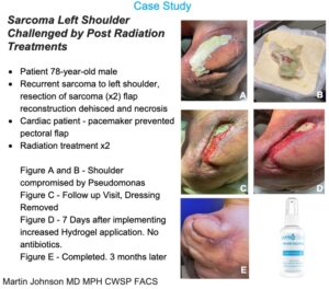 Pseudomonas Case Study